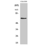 Western Blot - Anti-p70 S6 Kinase Antibody (B0534) - Antibodies.com