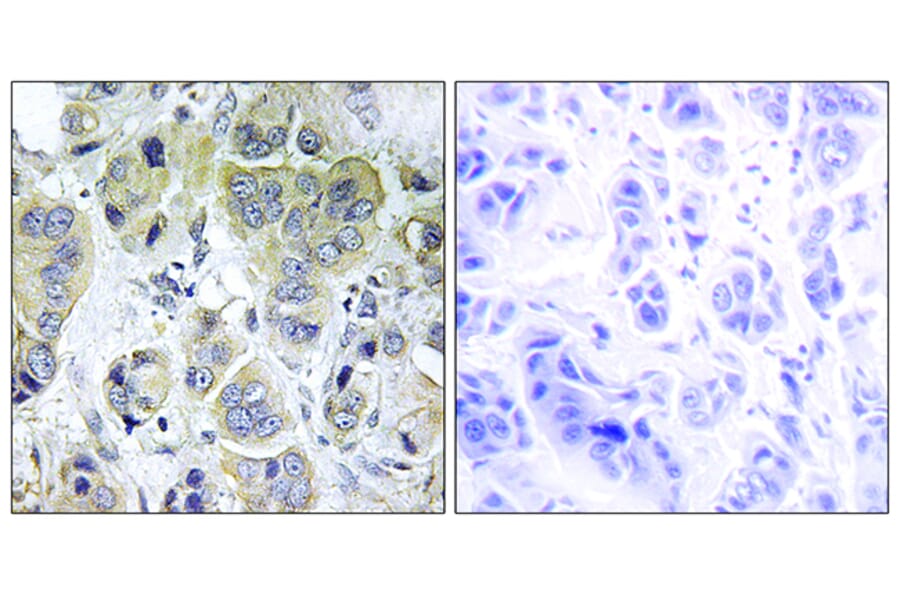 Immunohistochemistry - Anti-p70 S6 Kinase Antibody (B7188) - Antibodies.com