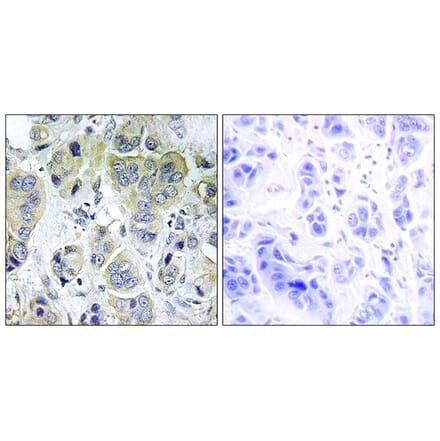 Immunohistochemistry - Anti-p70 S6 Kinase Antibody (B7188) - Antibodies.com