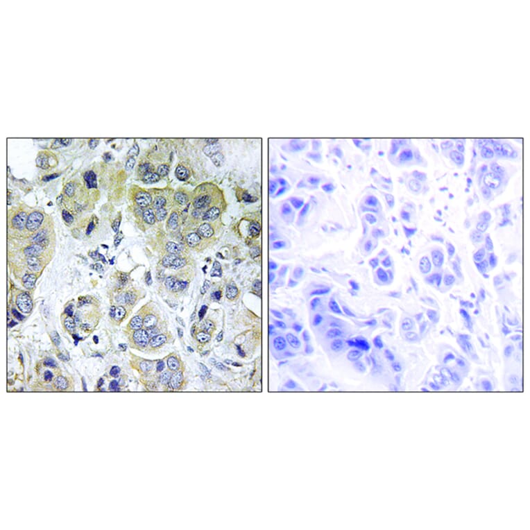 Immunohistochemistry - Anti-p70 S6 Kinase Antibody (B7188) - Antibodies.com