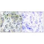 Immunohistochemistry - Anti-p70 S6 Kinase Antibody (B7188) - Antibodies.com