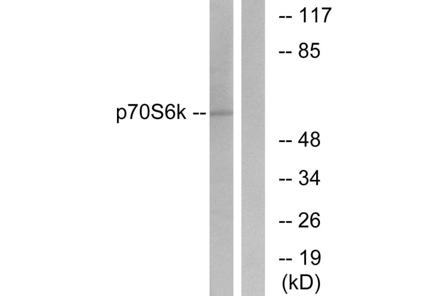 Western Blot - Anti-p70 S6 Kinase Antibody (B7188) - Antibodies.com