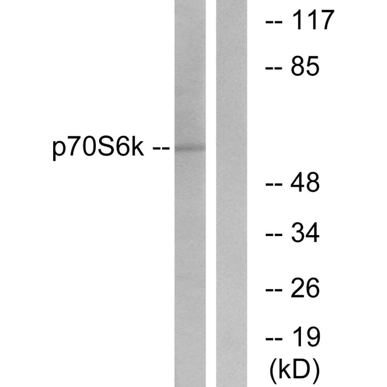 Western Blot - Anti-p70 S6 Kinase Antibody (B7188) - Antibodies.com