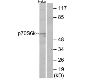 Western Blot - Anti-p70 S6 Kinase Antibody (B7189) - Antibodies.com