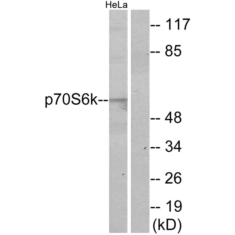 Western Blot - Anti-p70 S6 Kinase Antibody (B7189) - Antibodies.com