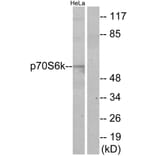 Western Blot - Anti-p70 S6 Kinase Antibody (B7189) - Antibodies.com