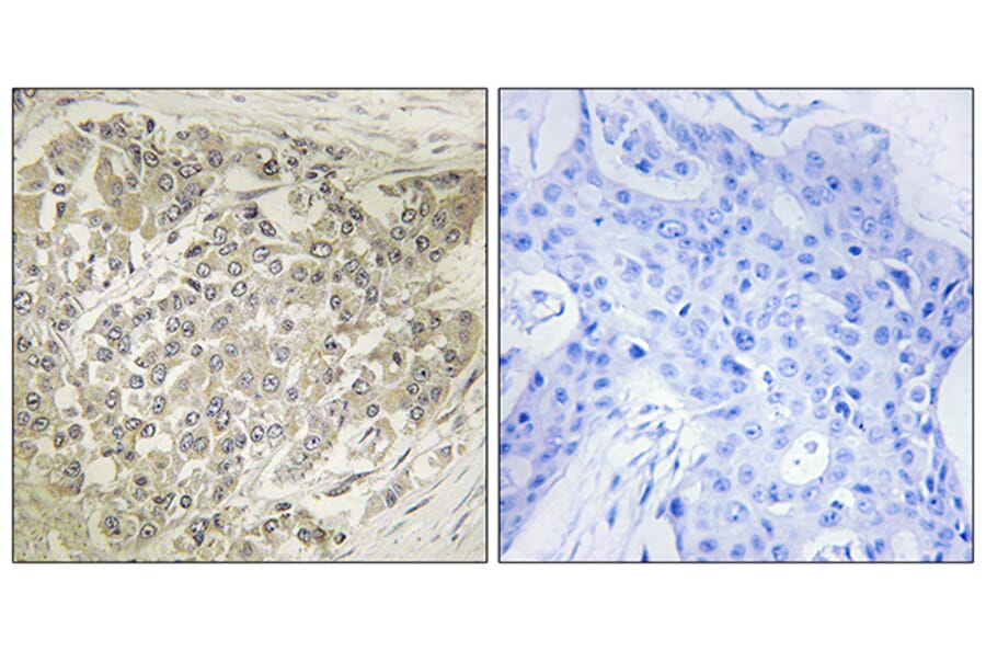 Immunohistochemistry - Anti-p70 S6 Kinase Antibody (B7189) - Antibodies.com