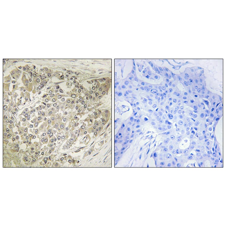 Immunohistochemistry - Anti-p70 S6 Kinase Antibody (B7189) - Antibodies.com