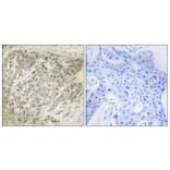 Immunohistochemistry - Anti-p70 S6 Kinase Antibody (B7189) - Antibodies.com