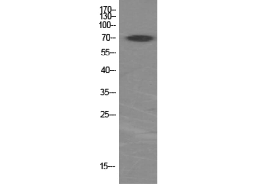 Western Blot - Anti-p70 S6 Kinase Antibody (B7189) - Antibodies.com