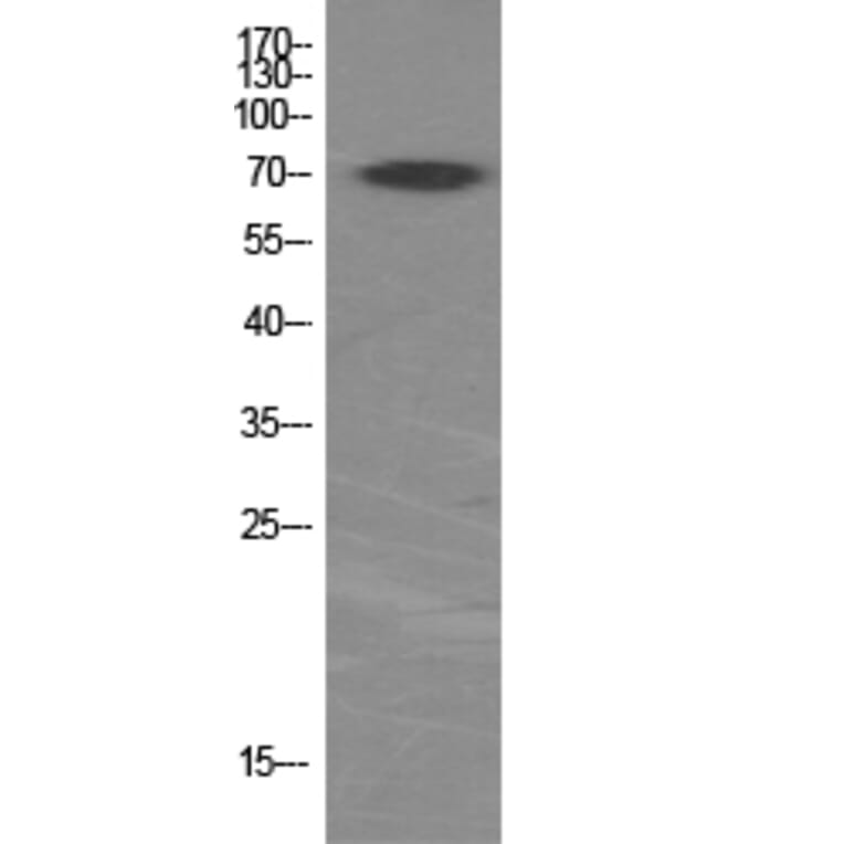 Western Blot - Anti-p70 S6 Kinase Antibody (B7189) - Antibodies.com