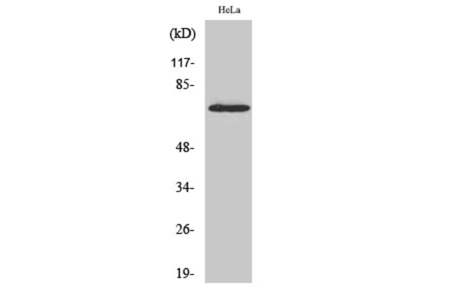 Western Blot - Anti-p70 S6 Kinase Antibody (B7189) - Antibodies.com