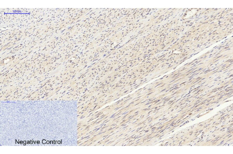 Immunohistochemistry - Anti-p70 S6 Kinase Antibody (B7189) - Antibodies.com