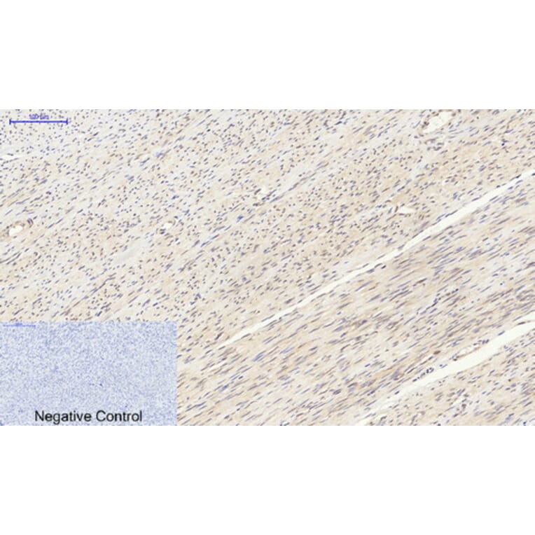 Immunohistochemistry - Anti-p70 S6 Kinase Antibody (B7189) - Antibodies.com