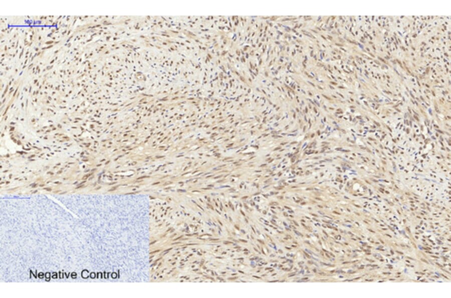Immunohistochemistry - Anti-p70 S6 Kinase Antibody (B7189) - Antibodies.com
