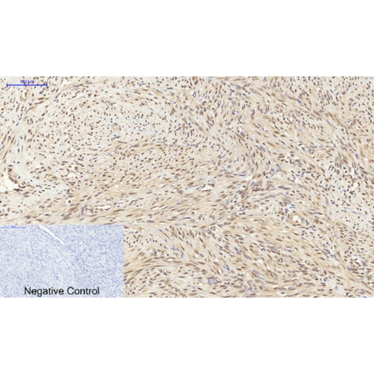 Immunohistochemistry - Anti-p70 S6 Kinase Antibody (B7189) - Antibodies.com
