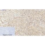 Immunohistochemistry - Anti-p70 S6 Kinase Antibody (B7189) - Antibodies.com
