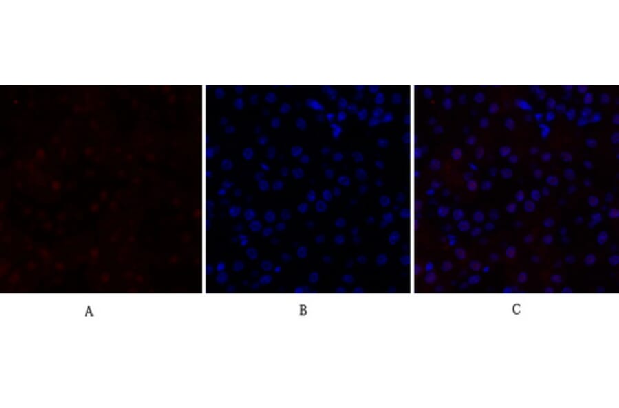Immunofluorescence - Anti-p70 S6 Kinase Antibody (B7189) - Antibodies.com