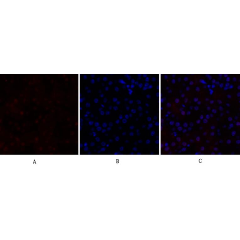 Immunofluorescence - Anti-p70 S6 Kinase Antibody (B7189) - Antibodies.com