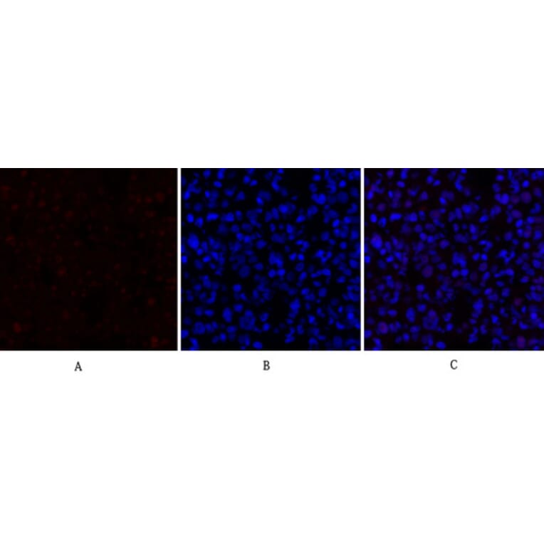 Immunofluorescence - Anti-p70 S6 Kinase Antibody (B7189) - Antibodies.com