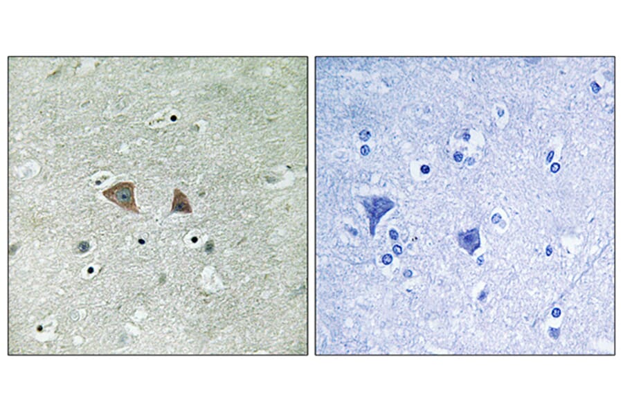 Immunohistochemistry - Anti-p70 S6 Kinase Antibody (B8156) - Antibodies.com