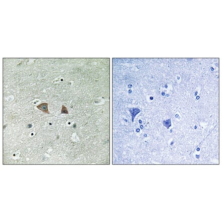 Immunohistochemistry - Anti-p70 S6 Kinase Antibody (B8156) - Antibodies.com