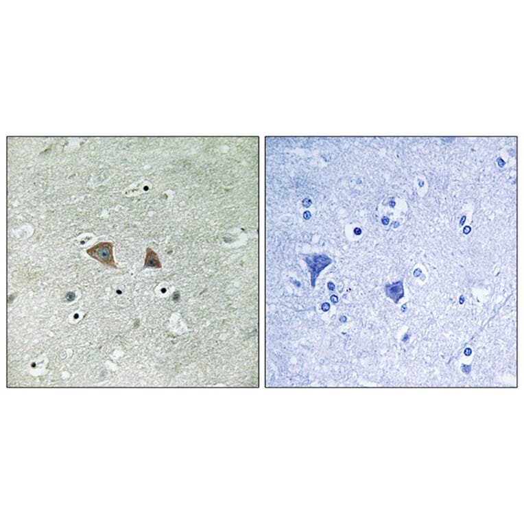 Immunohistochemistry - Anti-p70 S6 Kinase Antibody (B8156) - Antibodies.com