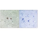 Immunohistochemistry - Anti-p70 S6 Kinase Antibody (B8156) - Antibodies.com