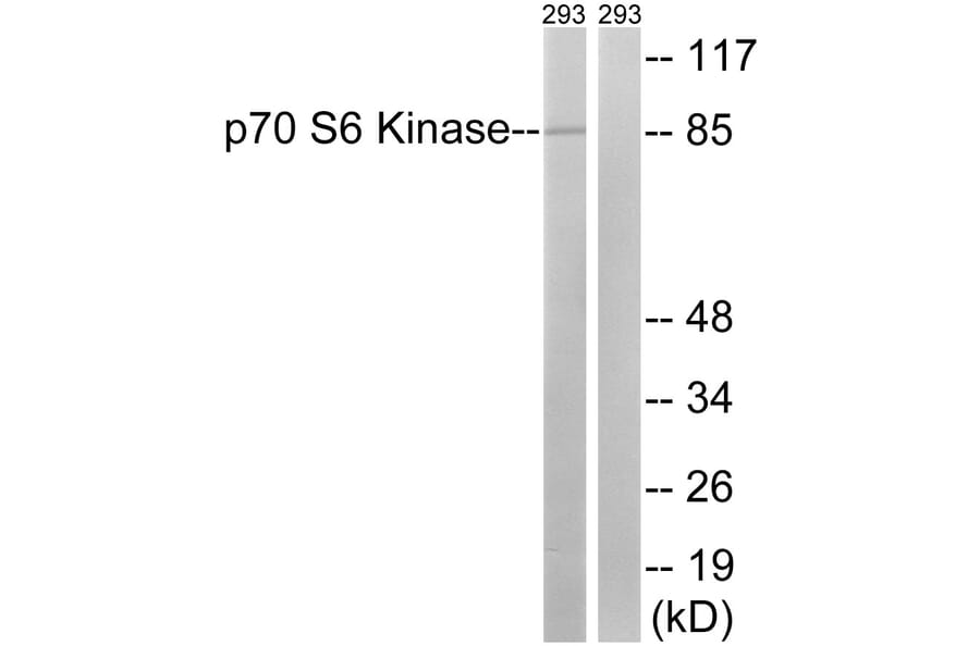 Western Blot - Anti-p70 S6 Kinase Antibody (B8156) - Antibodies.com