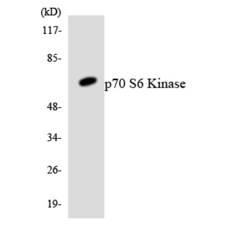 Western Blot - Anti-p70 S6 Kinase Antibody (R12-3291) - Antibodies.com