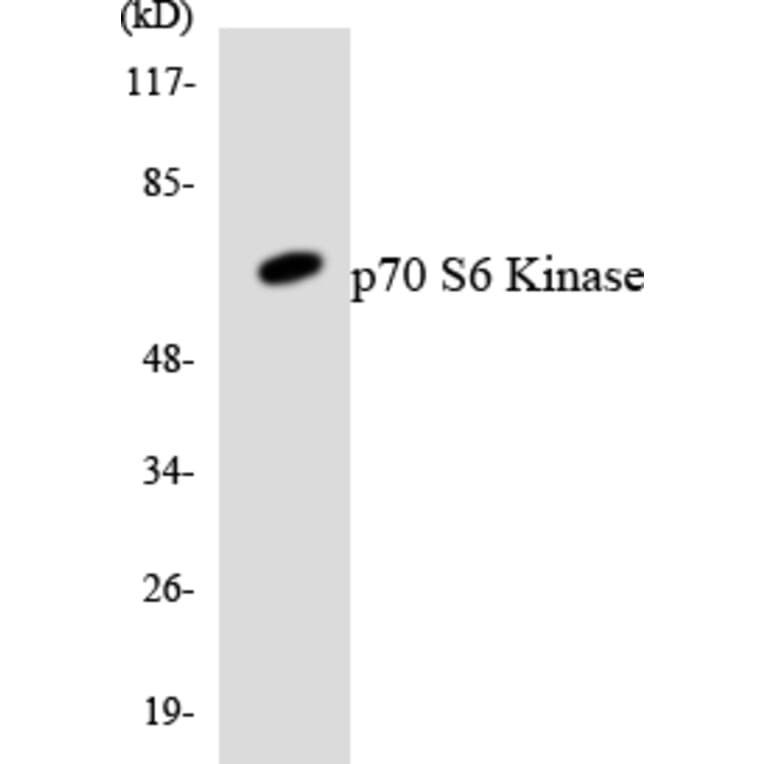 Western Blot - Anti-p70 S6 Kinase Antibody (R12-3291) - Antibodies.com