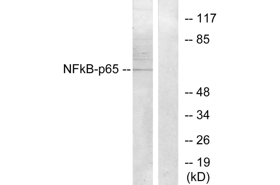 Western Blot - Anti-NF-kappaB p65 Antibody (B7172) - Antibodies.com