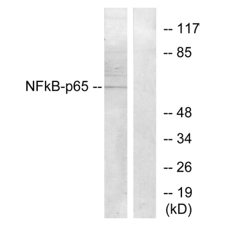 Western Blot - Anti-NF-kappaB p65 Antibody (B7172) - Antibodies.com