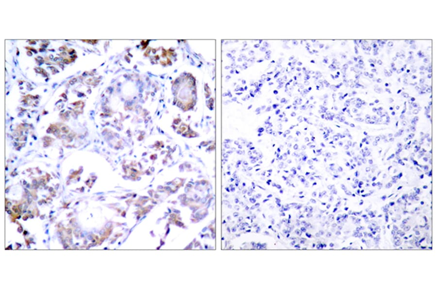 Immunohistochemistry - Anti-NF-kappaB p65 Antibody (B7172) - Antibodies.com