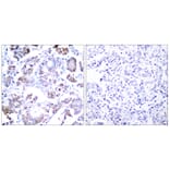 Immunohistochemistry - Anti-NF-kappaB p65 Antibody (B7172) - Antibodies.com