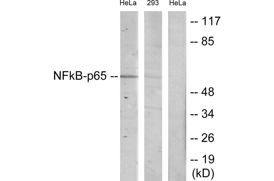 Western Blot - Anti-NF-kappaB p65 Antibody (B7170) - Antibodies.com