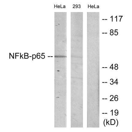 Western Blot - Anti-NF-kappaB p65 Antibody (B7170) - Antibodies.com