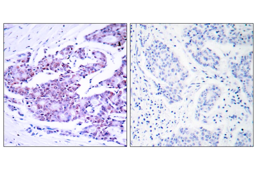Immunohistochemistry - Anti-NF-kappaB p65 Antibody (B7170) - Antibodies.com