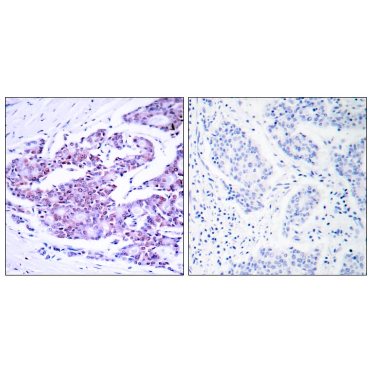 Immunohistochemistry - Anti-NF-kappaB p65 Antibody (B7170) - Antibodies.com