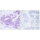 Immunohistochemistry - Anti-NF-kappaB p65 Antibody (B7170) - Antibodies.com