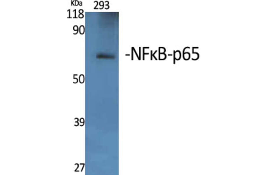 Western Blot - Anti-NF-kappaB p65 Antibody (B7170) - Antibodies.com