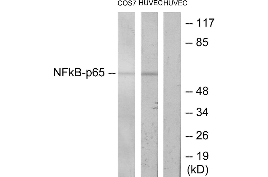 Western Blot - Anti-NF-kappaB p65 Antibody (B7173) - Antibodies.com