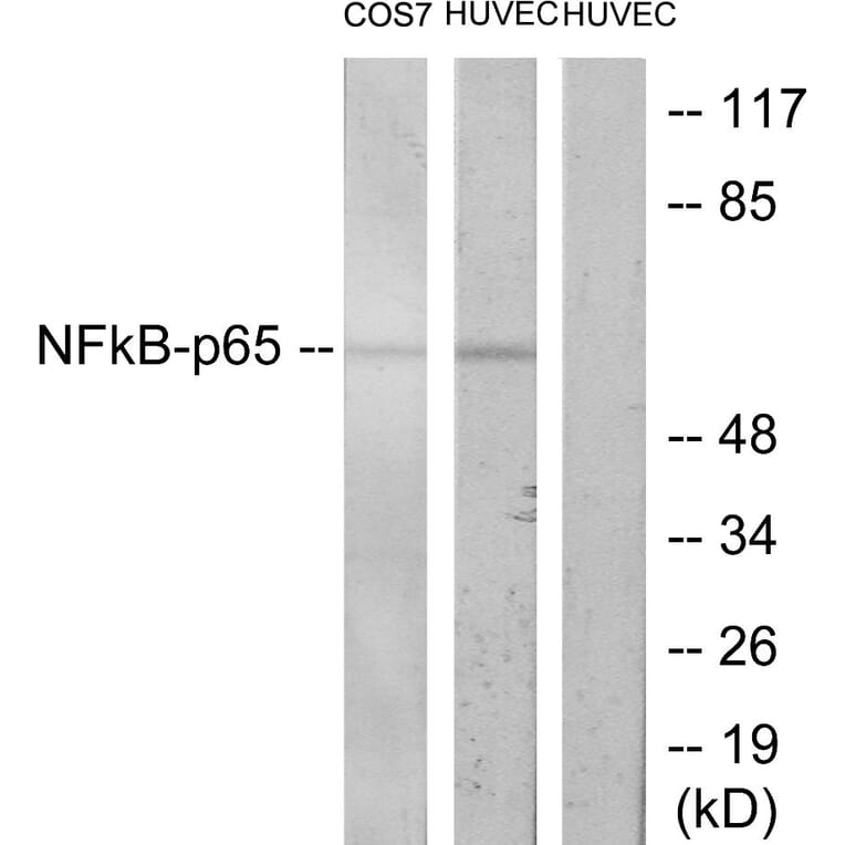 Western Blot - Anti-NF-kappaB p65 Antibody (B7173) - Antibodies.com