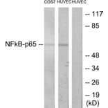 Western Blot - Anti-NF-kappaB p65 Antibody (B7173) - Antibodies.com