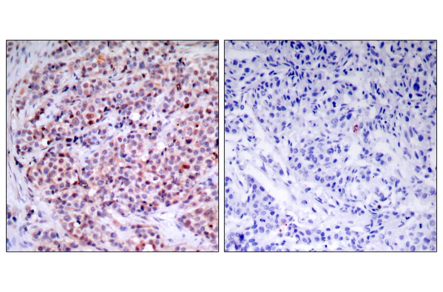 Immunohistochemistry - Anti-NF-kappaB p65 Antibody (B7173) - Antibodies.com