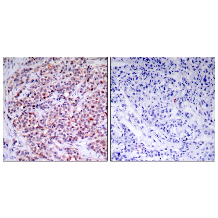 Immunohistochemistry - Anti-NF-kappaB p65 Antibody (B7173) - Antibodies.com