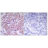 Immunohistochemistry - Anti-NF-kappaB p65 Antibody (B7173) - Antibodies.com