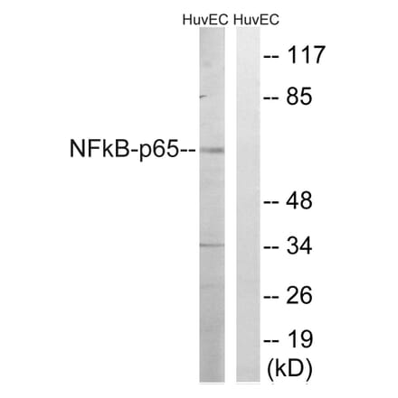 Western Blot - Anti-NF-kappaB p65 Antibody (B8049) - Antibodies.com