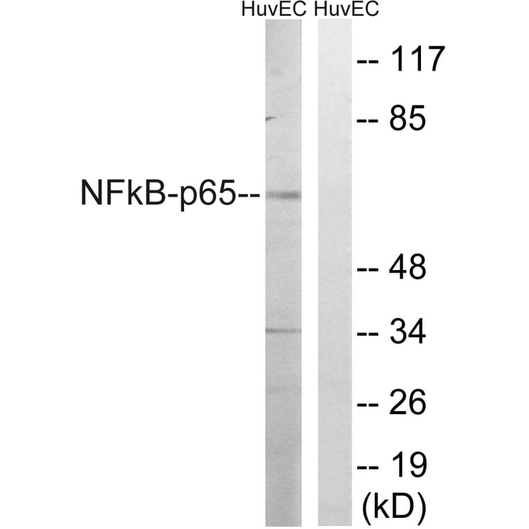 Western Blot - Anti-NF-kappaB p65 Antibody (B8049) - Antibodies.com