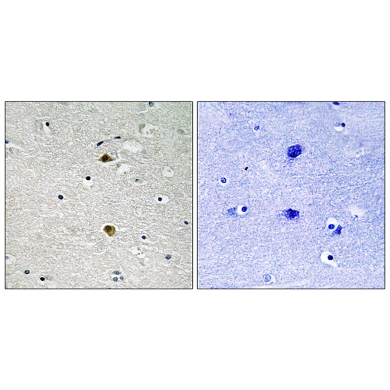 Immunohistochemistry - Anti-NF-kappaB p65 Antibody (B8049) - Antibodies.com